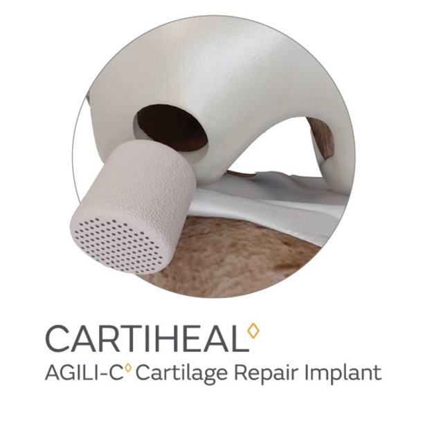 SMITH+NEPHEW UNVEILS EXPANDED SPORTS MEDICINE PORTFOLIO AT AAOS 2024